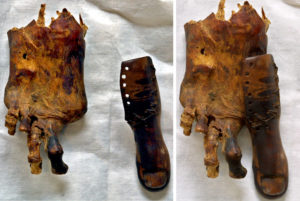 3000-річний дерев’яний палець − найдавніший протез